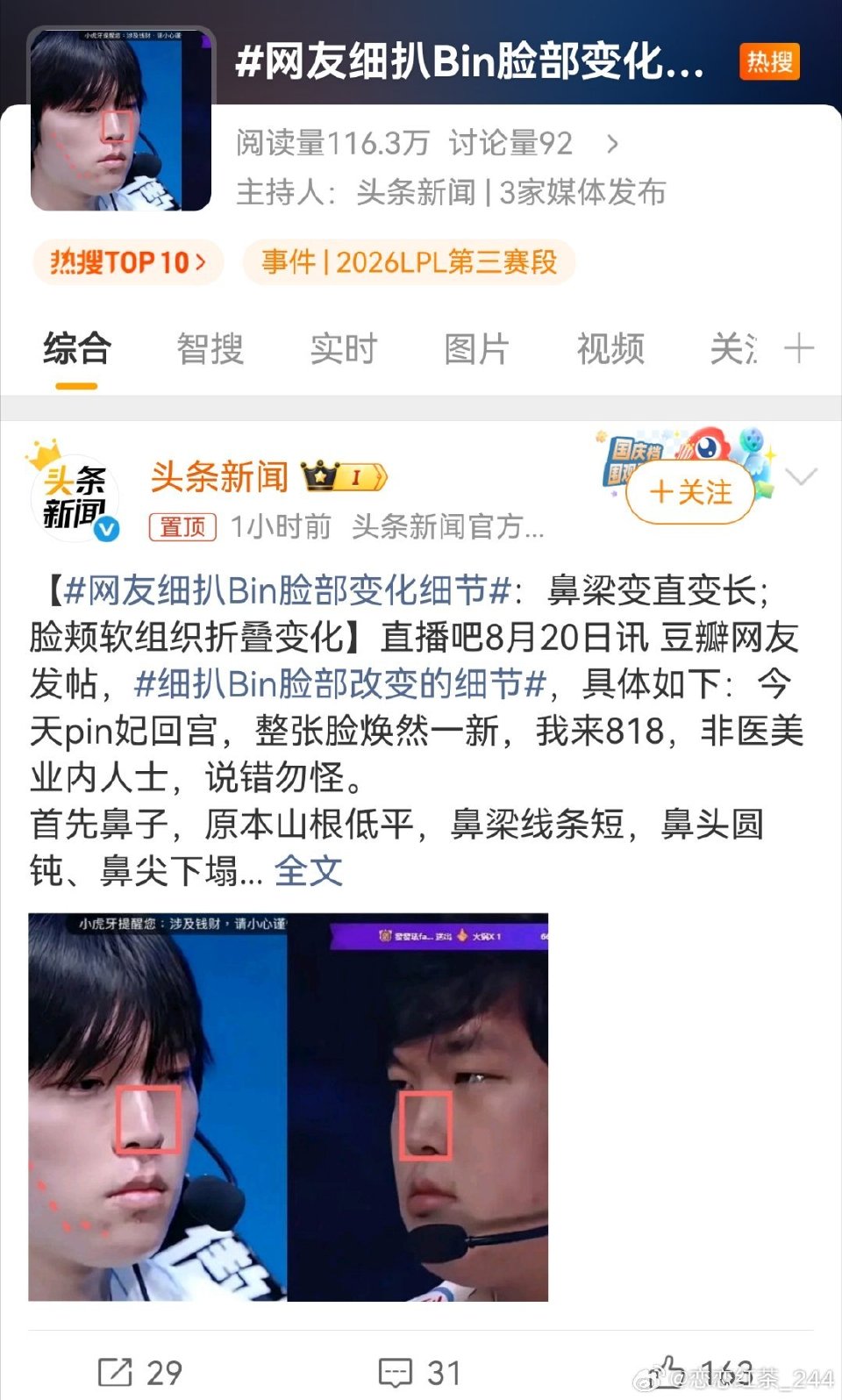 LPL顶流待遇：三家官媒齐推Bin脸部变化话题